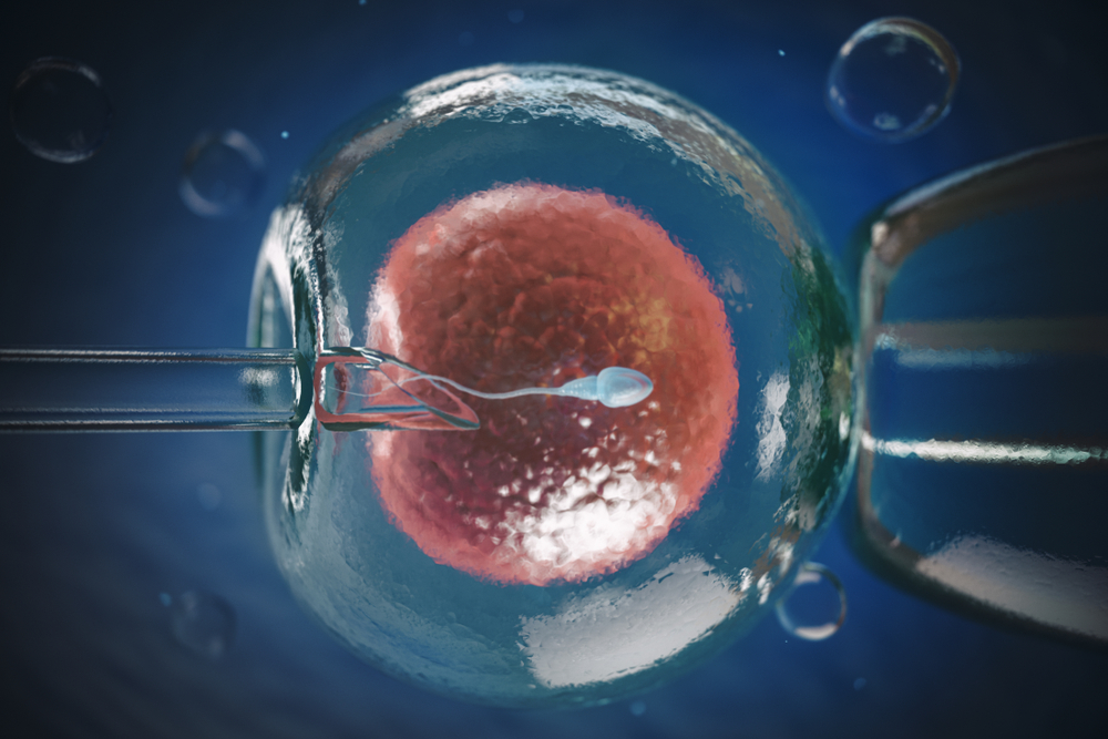 IVF là kỹ thuật hỗ trợ sinh sản hiện đại trong ống nghiệm.