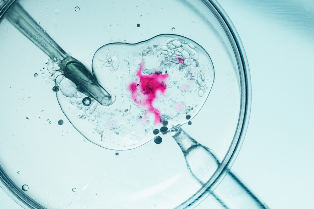 Các bước thụ tinh trong ống nghiệm IVF kéo dài nhiều tuần.